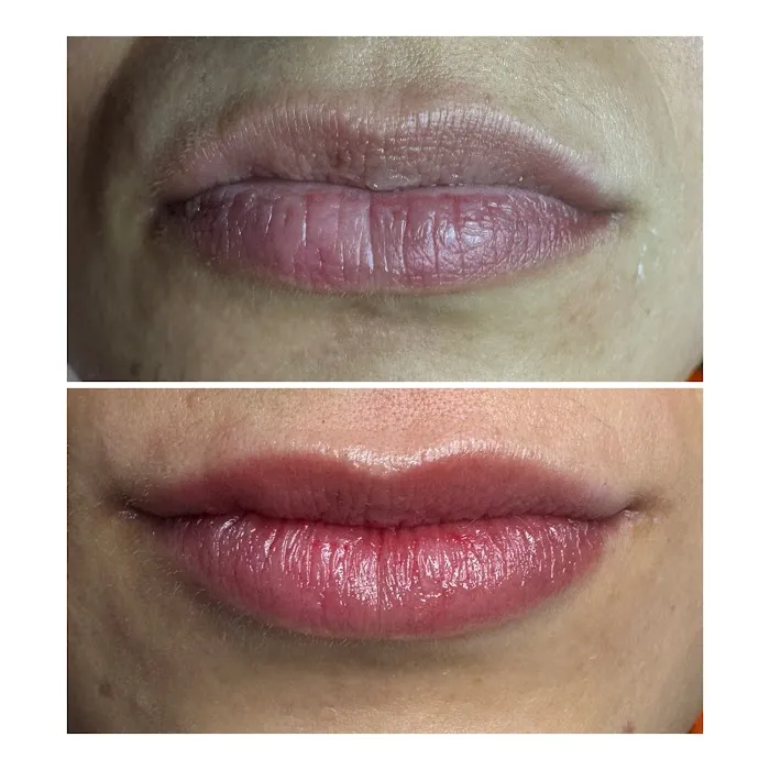 Skn by Sky Picture 2