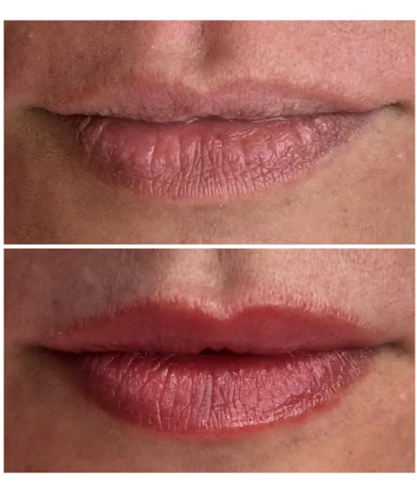 Skn by Sky Picture 10