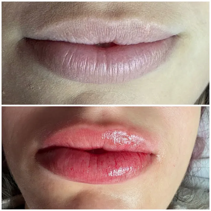 Skn by Sky Picture 9