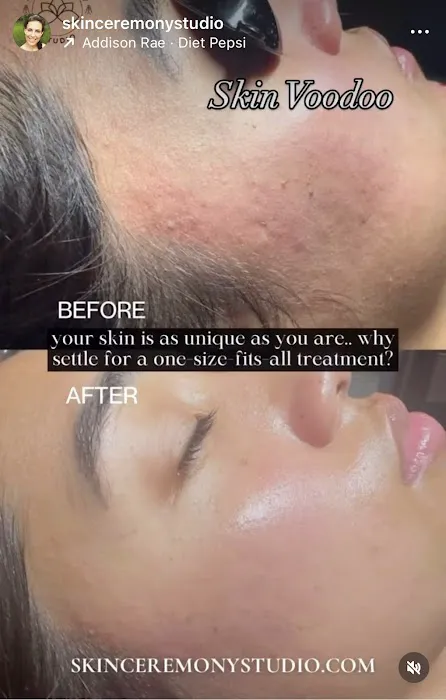 Skin Ceremony Studio Picture 7