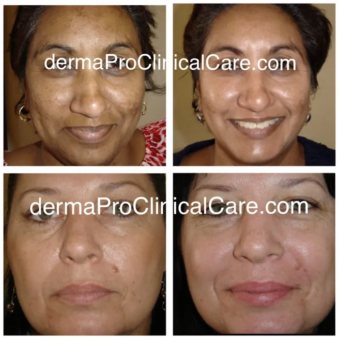 dermaPro Clinical Care Picture 9