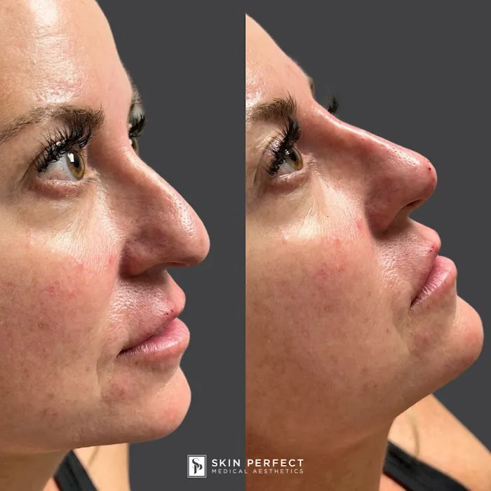 Skin Perfect Medical Aesthetics Picture 2