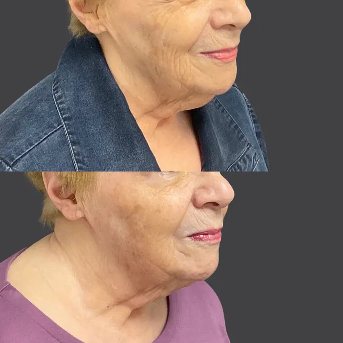 Skin Perfect Medical Aesthetics Picture 9