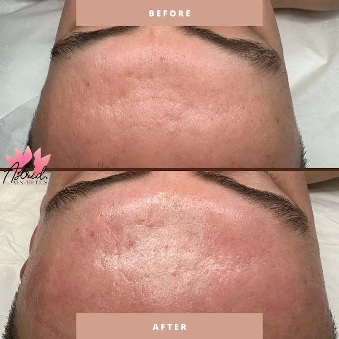 Astrid Aesthetics Picture 4