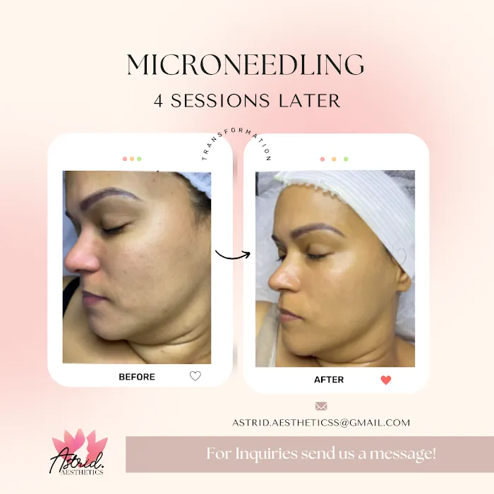 Astrid Aesthetics Picture 5