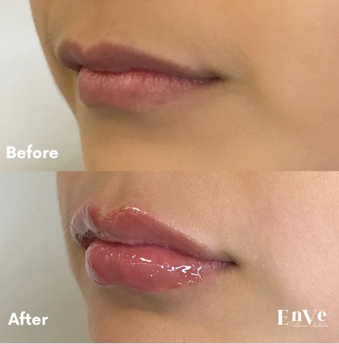 Enve California Aesthetics Picture 3