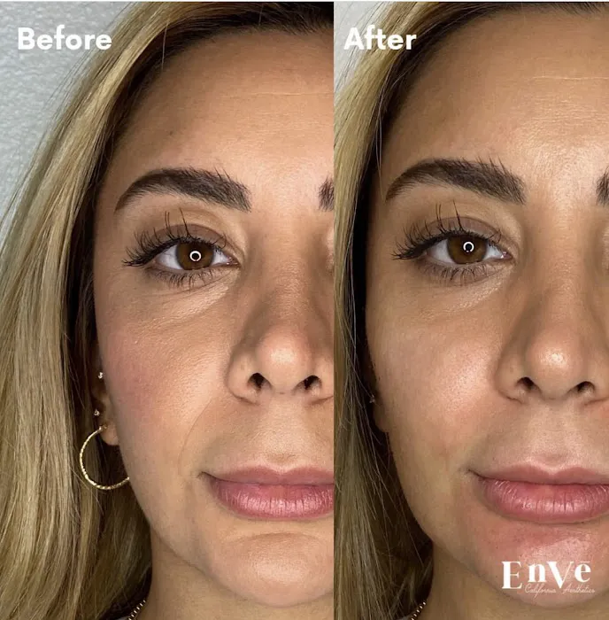 Enve California Aesthetics Picture 4