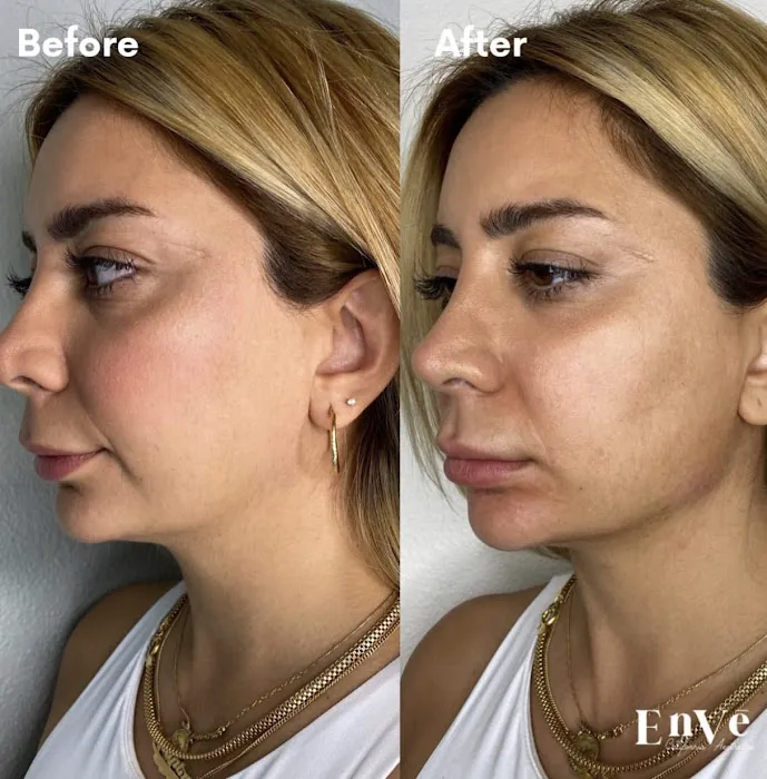 Enve California Aesthetics Picture 5