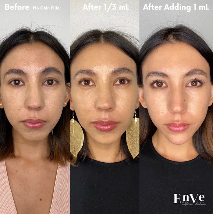 Enve California Aesthetics Picture 6