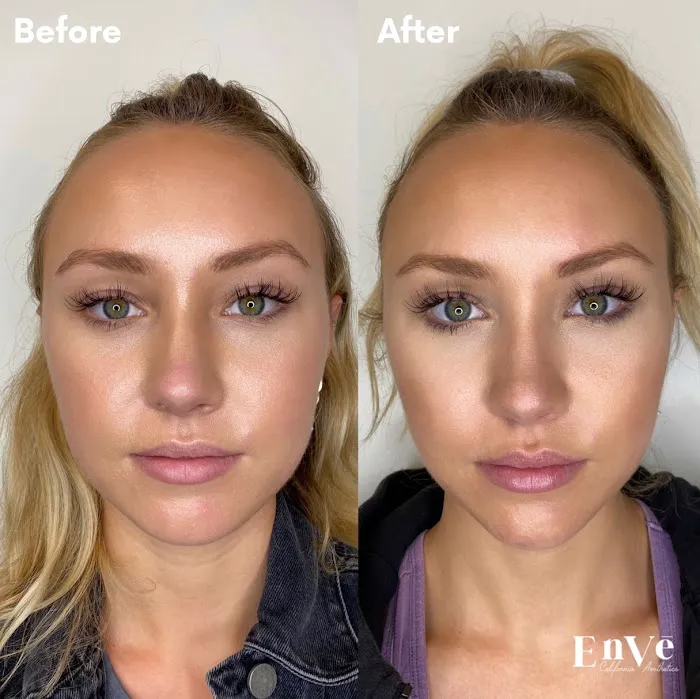 Enve California Aesthetics Picture 7