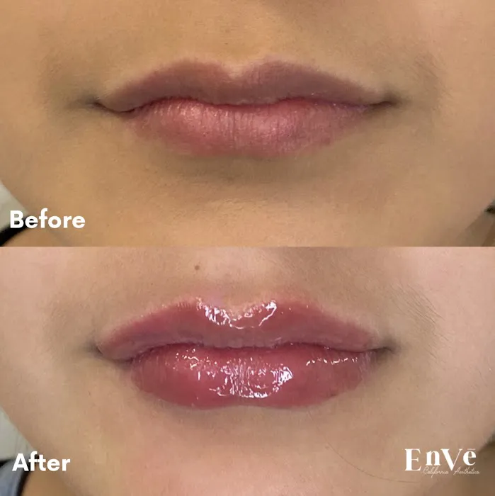 Enve California Aesthetics Picture 9