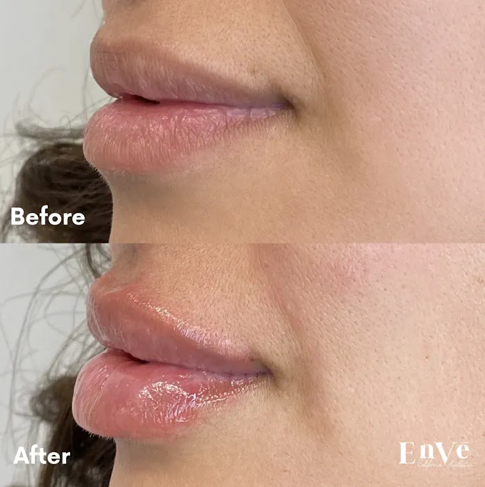 Enve California Aesthetics Picture 10