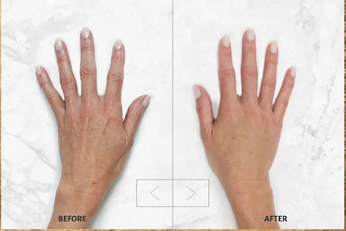 Botox It Andrea Dunkelman MD, FACS Picture 3