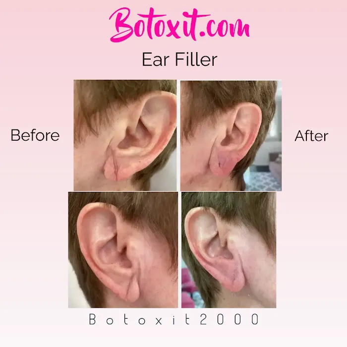 Botox It Andrea Dunkelman MD, FACS Picture 8