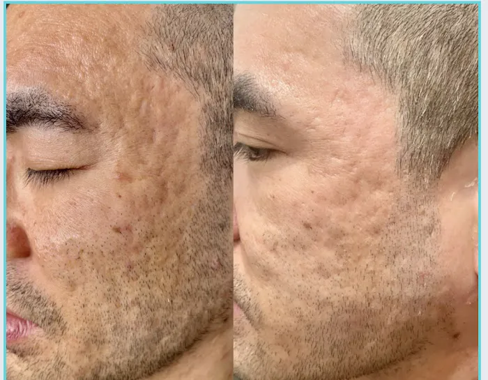 PHD SkinHealth Picture 3