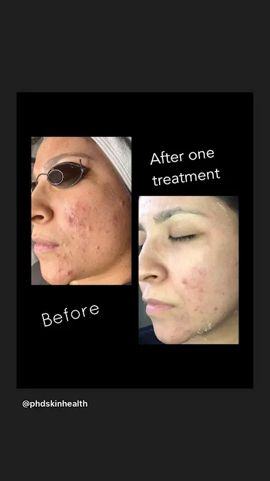 PHD SkinHealth Picture 2