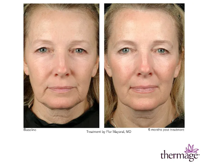 Before & After Skincare Clinic Picture 9