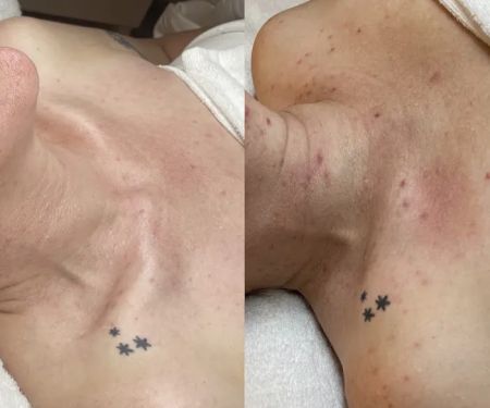 Joanna Moreno Skincare