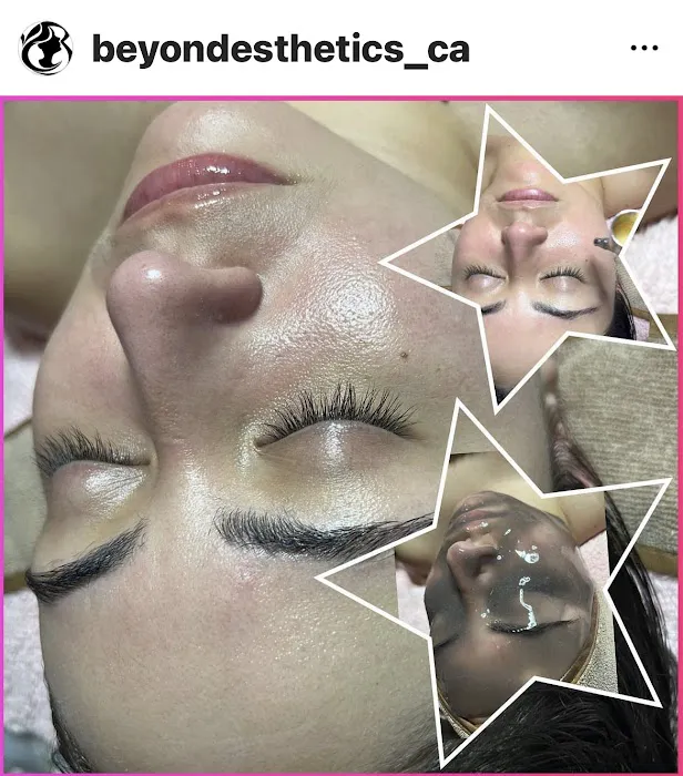 Beyond Esthetics, LLC Picture 3