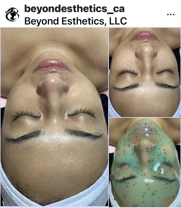 Beyond Esthetics, LLC Picture 5