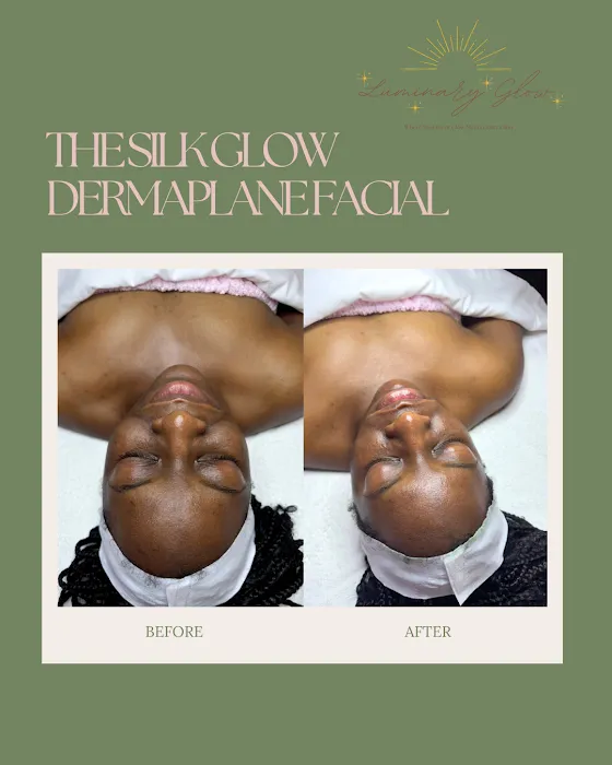 Luminary Glow Picture 9