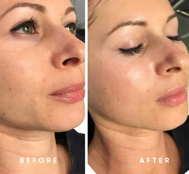 MAE, Modern Aesthetic Essence, Skincare Picture 10