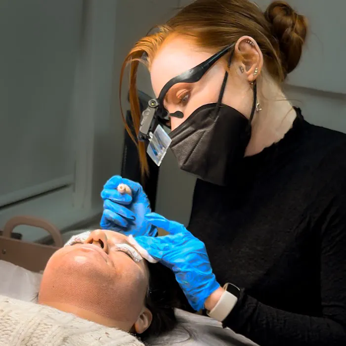 Fibroblast Facelift Picture 2