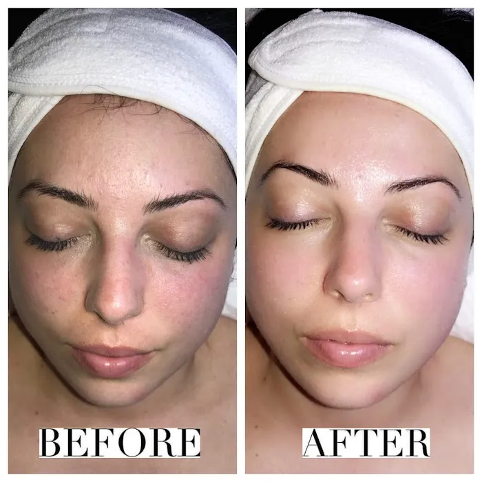 thebodyface Picture 6