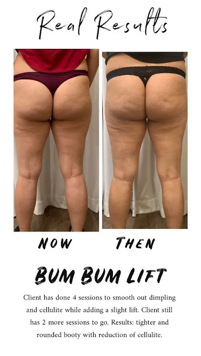 thebodyface Picture 10