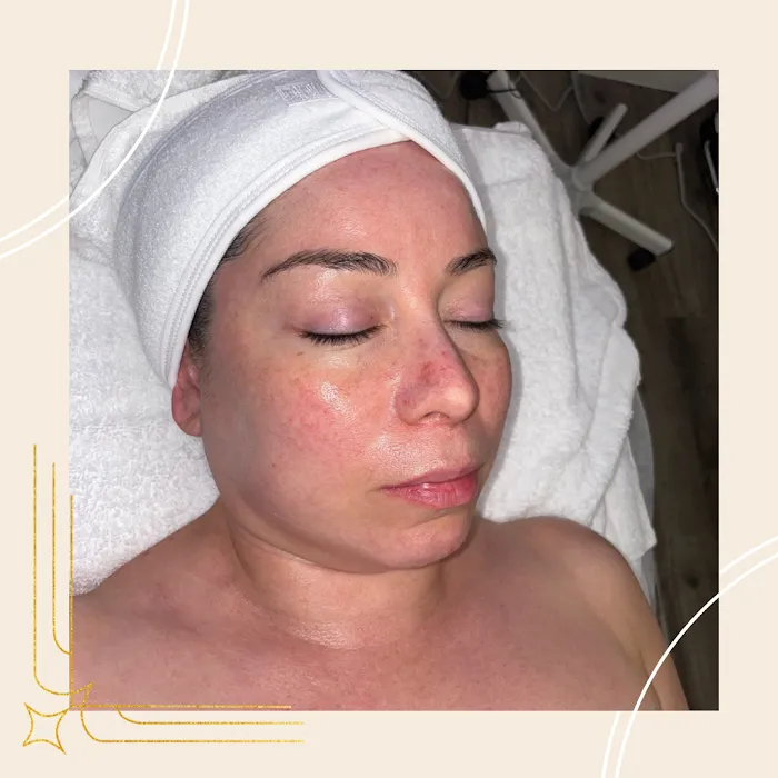 GALABIZ ESTHETICS Picture 3