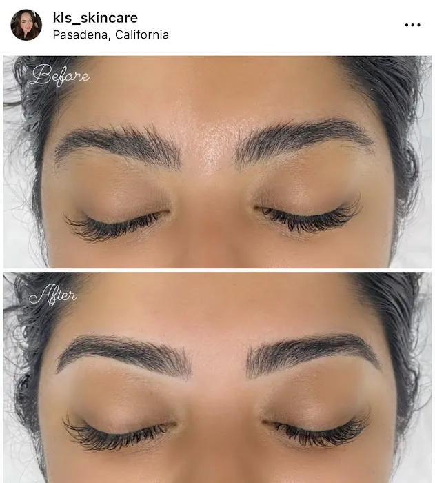 KLS Skincare Picture 3