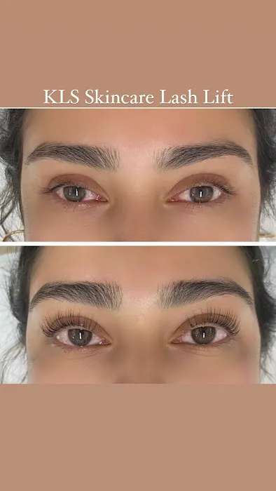 KLS Skincare Picture 10