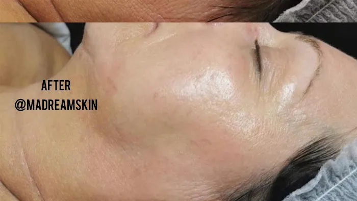 M.A DREAM SKIN Picture 1