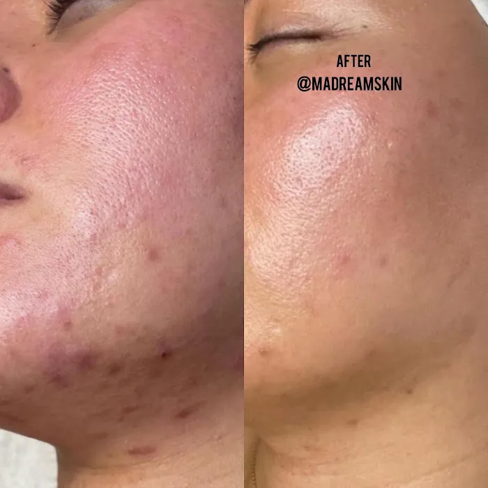 M.A DREAM SKIN Picture 2