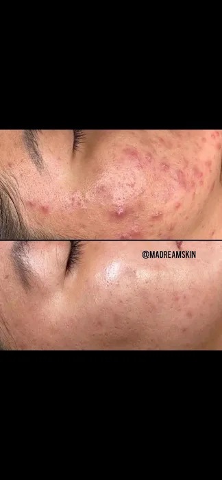 M.A DREAM SKIN Picture 7