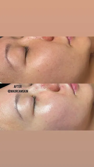 M.A DREAM SKIN Picture 10