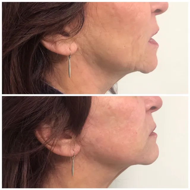 Lantry Aesthetic & Skincare Center Glendale CA Picture 6