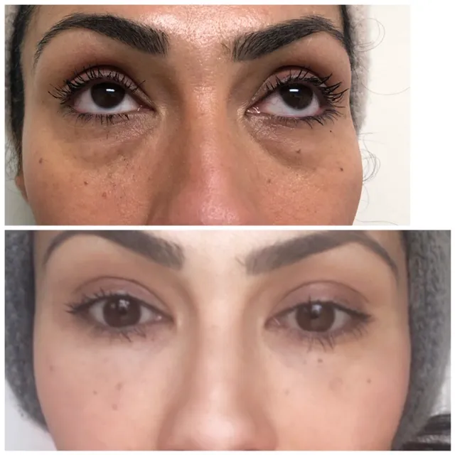 Lantry Aesthetic & Skincare Center Glendale CA Picture 8