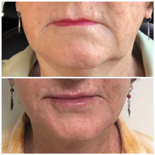 Lantry Aesthetic & Skincare Center Glendale CA Picture 7