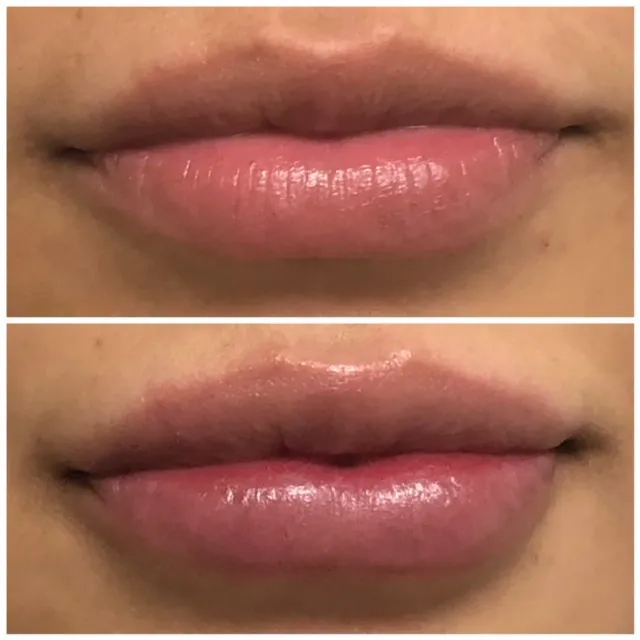 Lantry Aesthetic & Skincare Center Glendale CA Picture 10