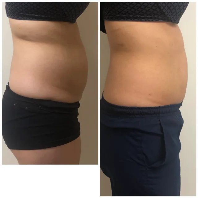 Lantry Aesthetic & Skincare Center Glendale CA Picture 9