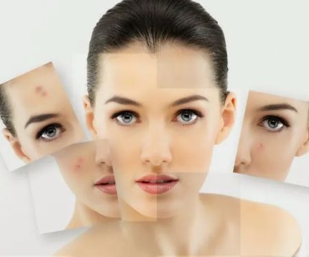 Avant Esthetic Skin Solutions