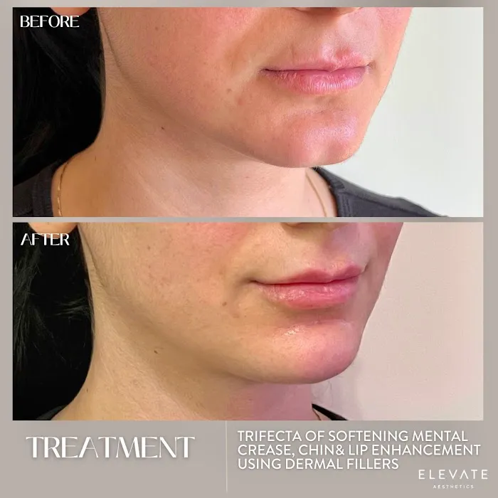 Elevate Aesthetics Picture 7