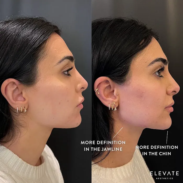 Elevate Aesthetics Picture 6