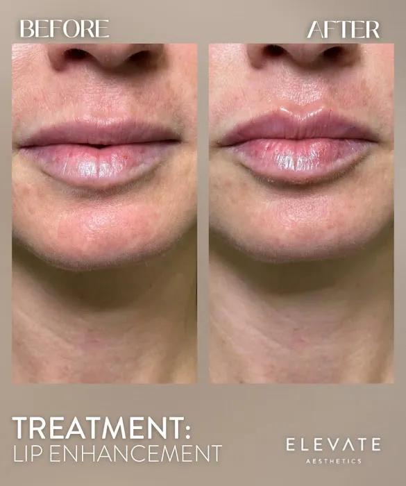 Elevate Aesthetics Picture 8