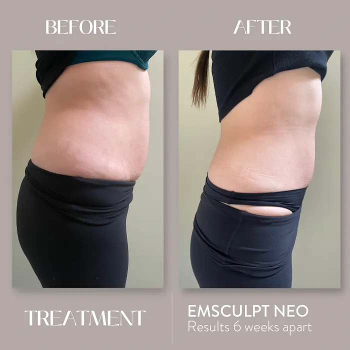 Elevate Aesthetics Picture 10