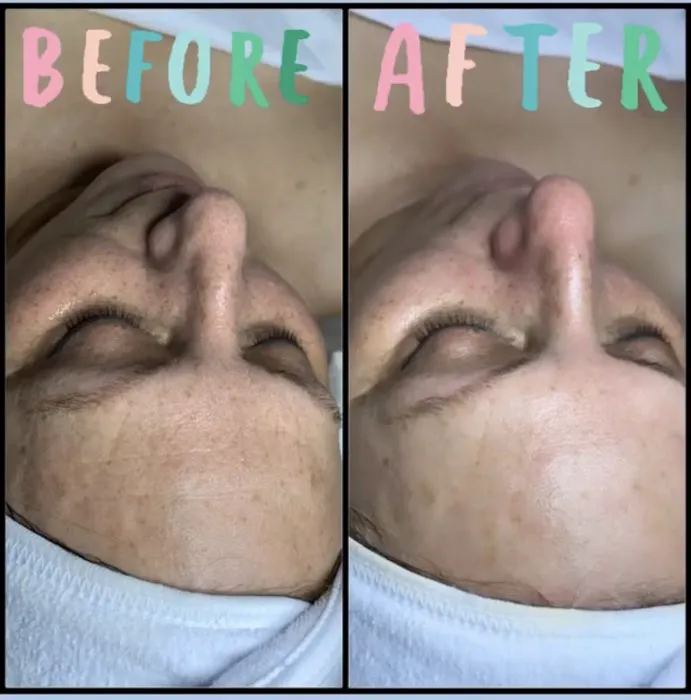 Face by Adana Picture 4