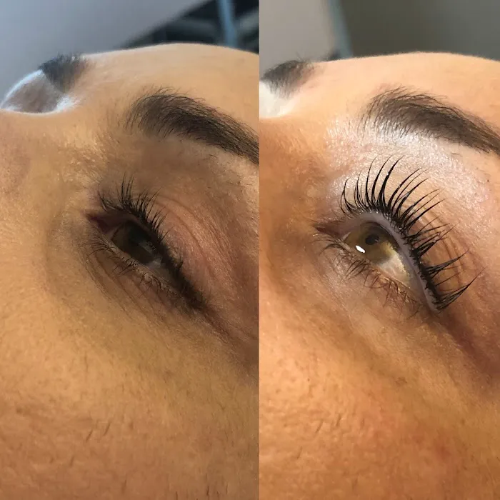 MDT Skincare Picture 2