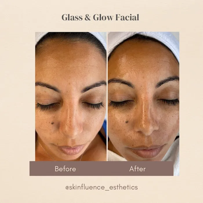 Skinfluence Esthetics Picture 6