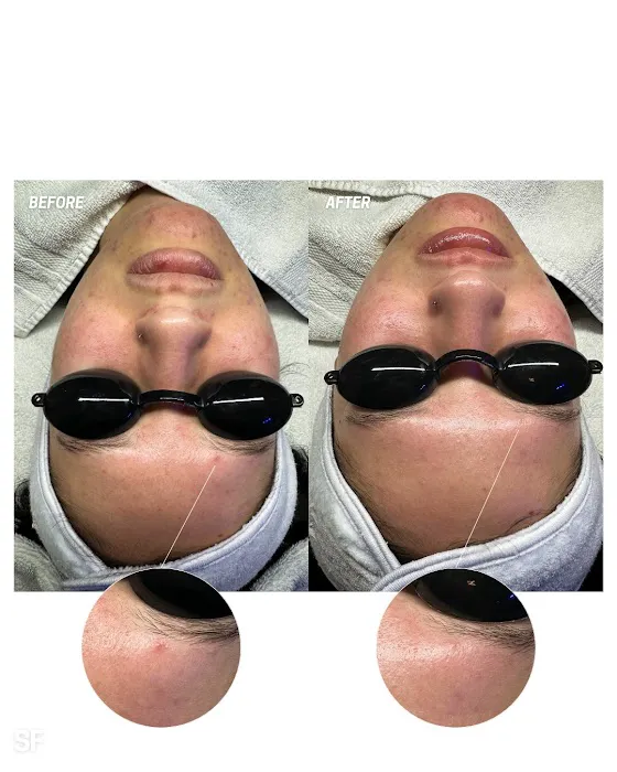 Skinfluence Esthetics Picture 9